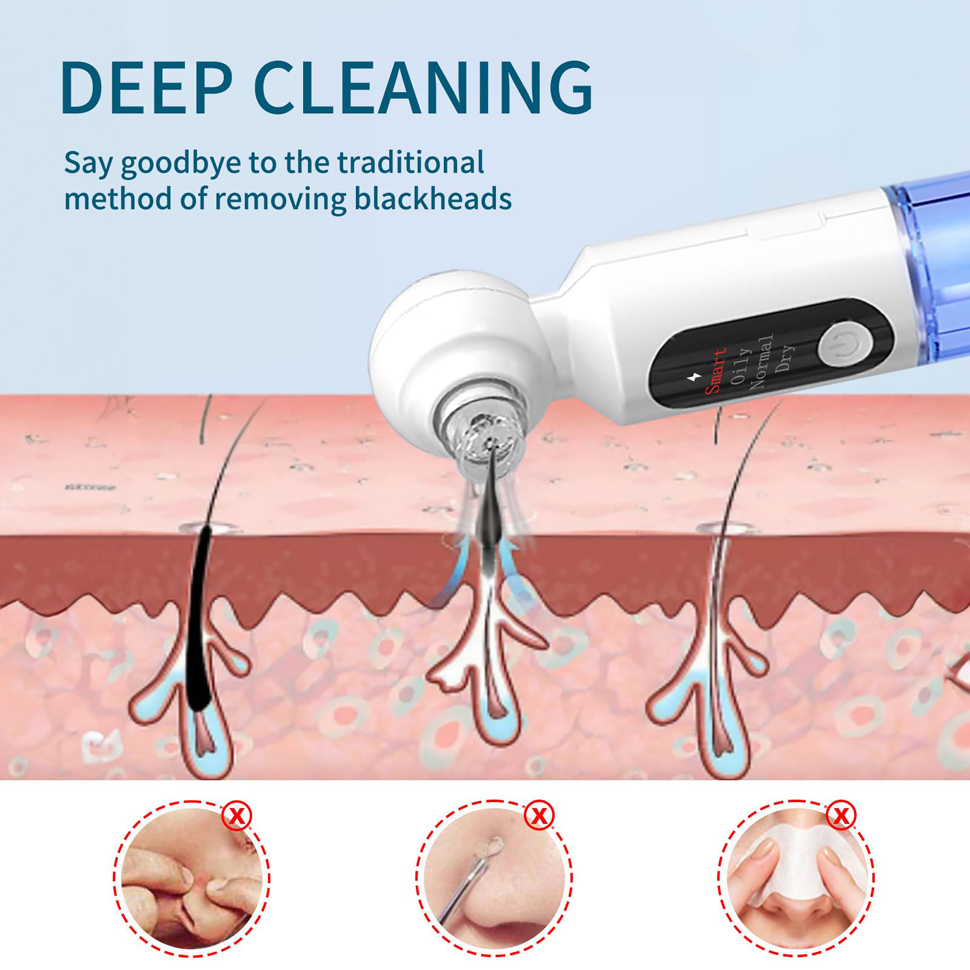 Siyah Nokta Temizleyici Gözene - Pore Vacuum incelemesi ve fiyatı