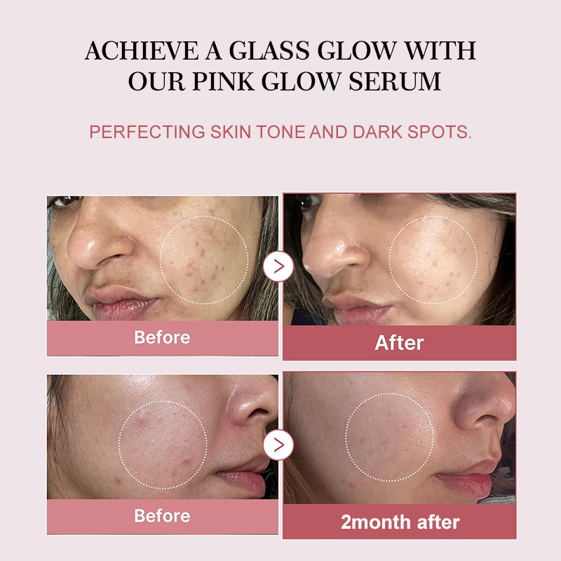 Donuk Ciltler İçin Somon PDRN  - Beauty Makeup Korean incelemesi ve fiyatı